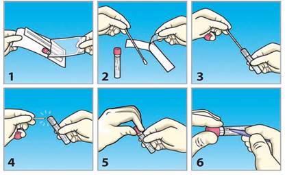 Labogids E Swab Instructies