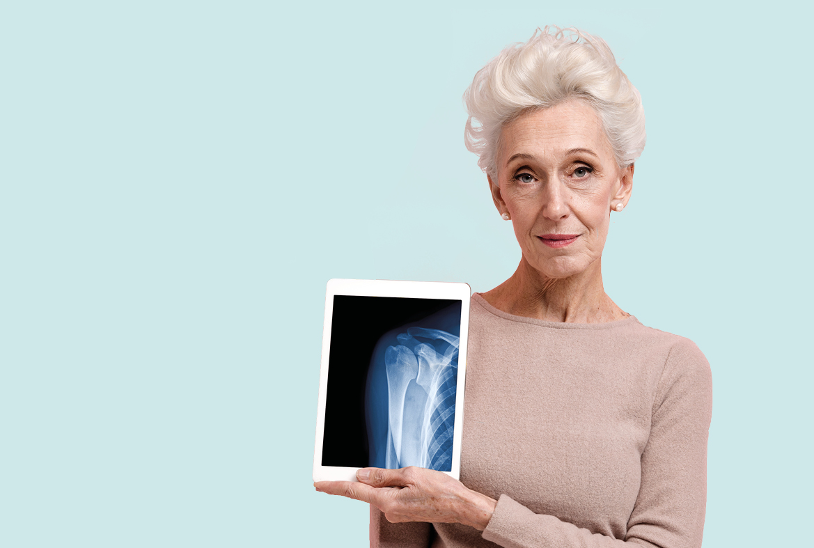 Osteoporose Banner Website